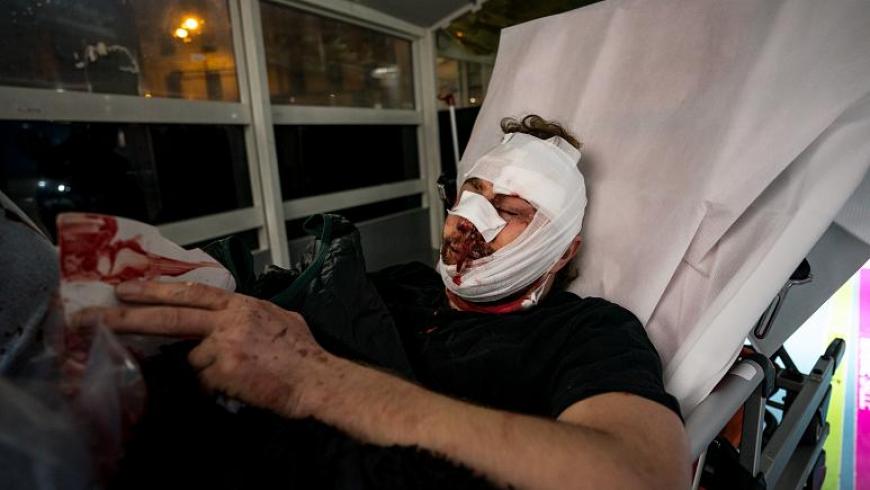 فرنسا تحقق في الاعتداء على المصور السوري أمير الحلبي
