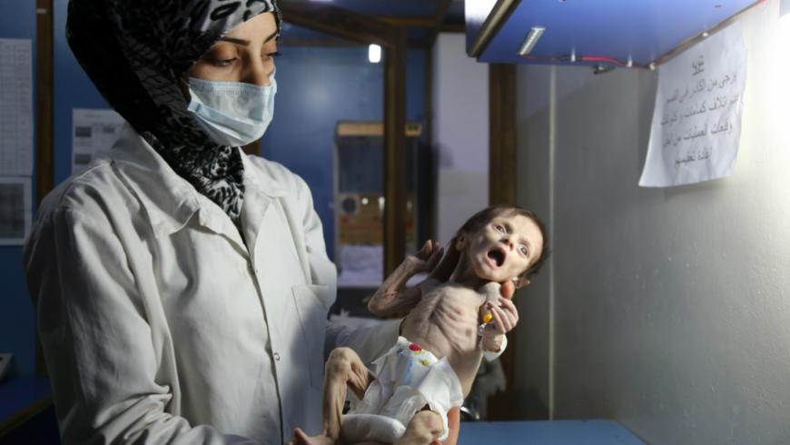 سوء التغذية يعرض ثلث أطفال الشمال السوري لخطر الموت