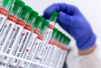 أنابيب اختبار فيروس مرض جدري القردة (رويترز)