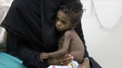 تحذيرات من أزمة غذائية في اليمن (الأناضول)