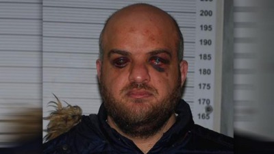 مجدي نعمة أو إسلام علوش بعد تعرضه للتعذيب في السجون الفرنسية (إنترنت)