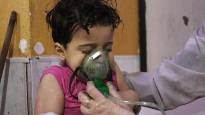 طفل يتلقى العلاج بعد هجوم بالغاز السام من قبل نظام الأسد في الغوطة السورية. تصوير: وكالة الأناضول / غيتي إيماجز
