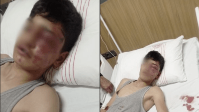الطفل السوري يرقد في المستشفى بعد تعرضه للتعذيب (طه الغازي)